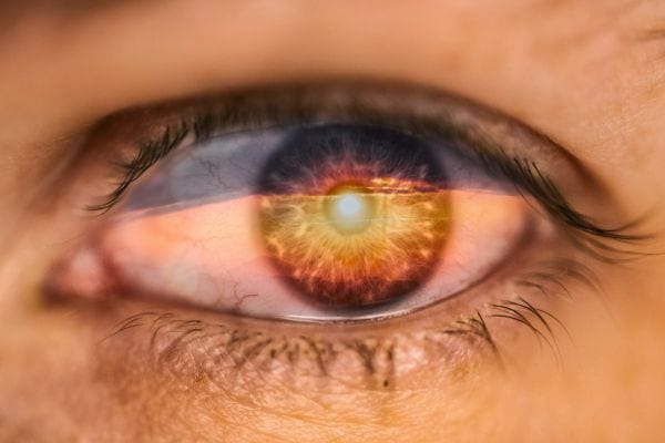 presbylasik avis ophtalmo paris specialiste chirurgie refractive chirurgie laser yeux paris dr romain nicolau presbylasik avis ophtalmo paris specialiste chirurgie refractive chirurgie laser yeux paris dr romain nicolau