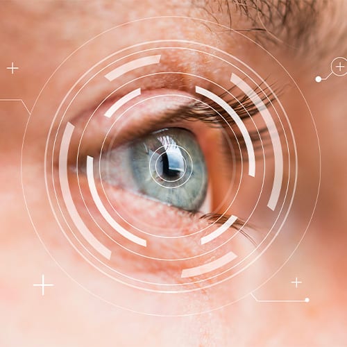 site principal dr romain nicolau chirurgien ophtalmologue specialiste chirurgie refractive paris
