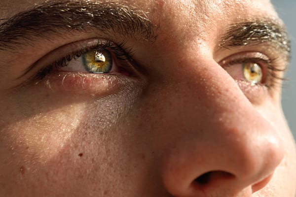 douleur apres pkr docteur romain nicolau specialiste chirurgie refractive chirurgie laser yeux ophtalmo paris