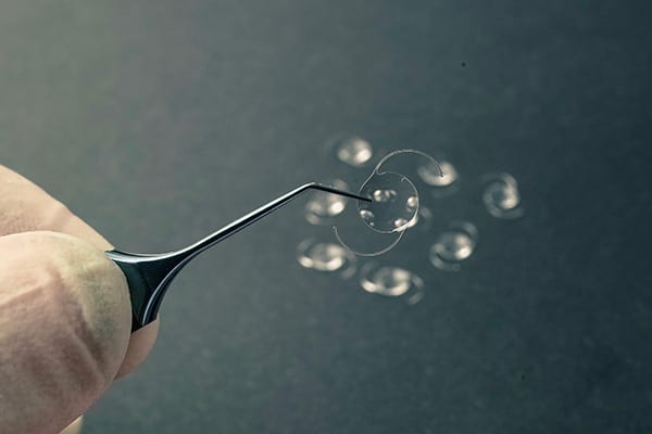 implant phaque avis docteur romain nicolau specialiste chirurgie refractive chirurgie laser yeux ophtalmo paris implant phaque avis docteur romain nicolau specialiste chirurgie refractive chirurgie laser yeux ophtalmo paris