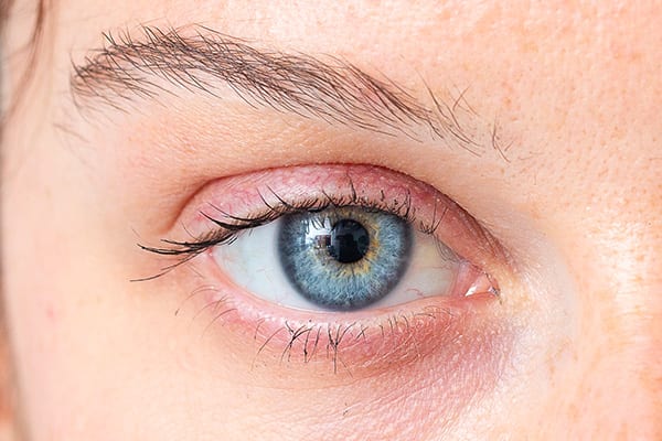 transpkr docteur romain nicolau specialiste chirurgie refractive chirurgie laser yeux ophtalmo paris transpkr docteur romain nicolau specialiste chirurgie refractive chirurgie laser yeux ophtalmo paris