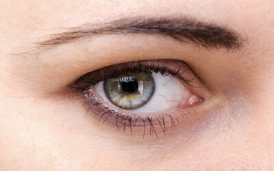 Opération de l’hypermétropie : est-ce que l’hypermétropie s’opère ?