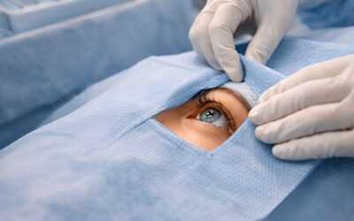 Opération SMILE des yeux : déroulement de l&rsquo;intervention