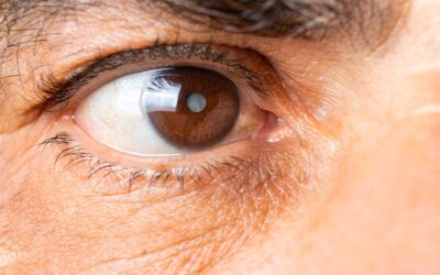 VisuMax 800 et cataracte : pour quels cas est-il préconisé ?